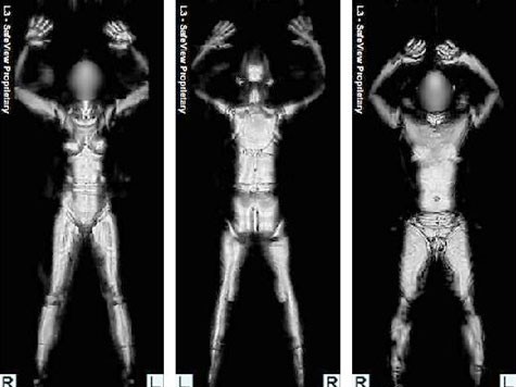 BodyScanner